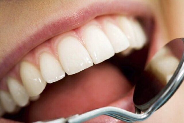آغاز کمپین «دهان دریچه سلامتی»
